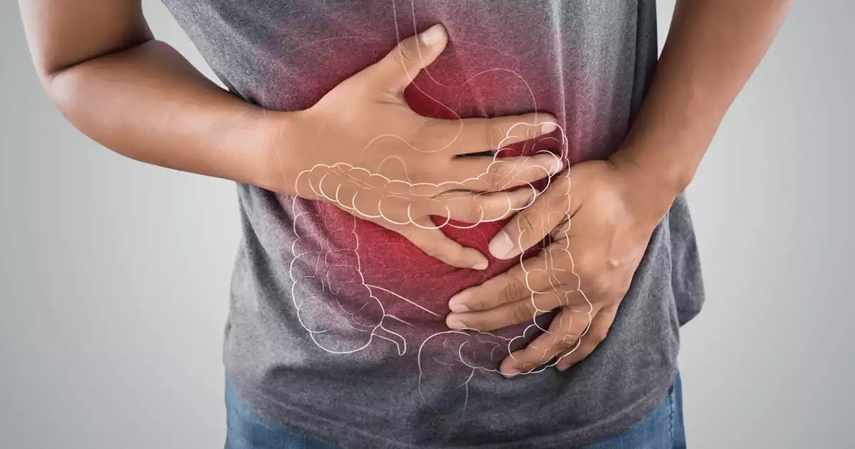 Ibs Signs And Symptoms