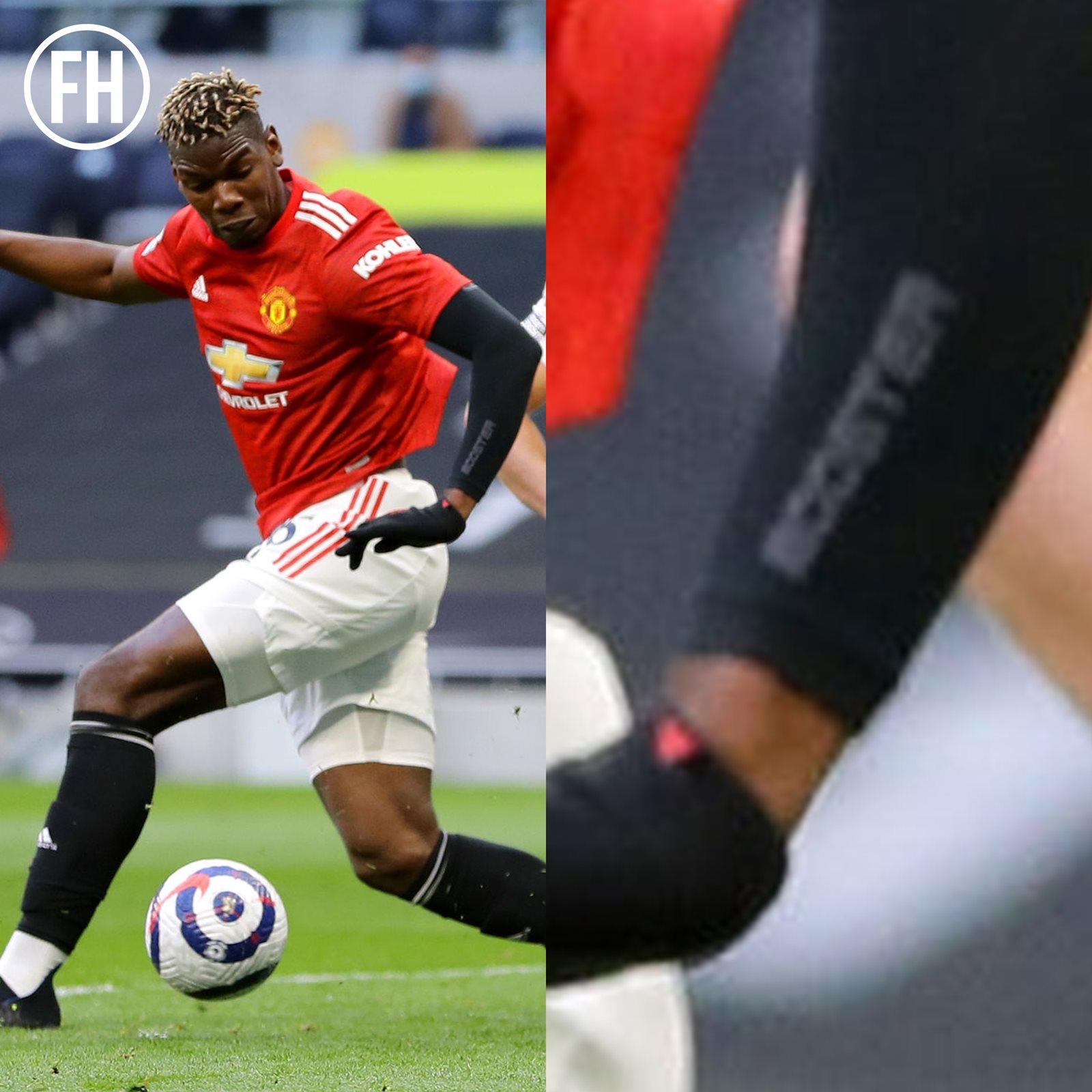 Why Is Paul Pogba Wearing A Sleeve On His Arm? And Is It Even Allowed