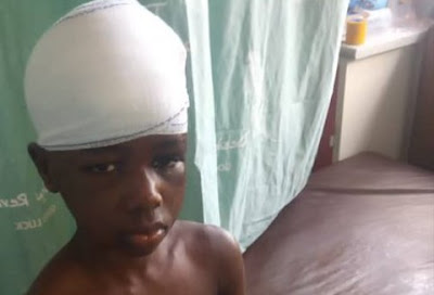 Enugu Lady Drills Nails Into 10-Year-Old Maid’s Head, Peels Her Skin With Electric Iron