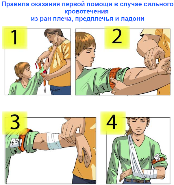 Как сделать жгут на шею. Смотреть фото Как сделать жгут на шею. Смотреть картинку Как сделать жгут на шею. Картинка про Как сделать жгут на шею. Фото Как сделать жгут на шею Как сделать жгут на шею. Смотреть фото Как сделать жгут на шею. Смотреть картинку Как сделать жгут на шею. Картинка про Как сделать жгут на шею. Фото Как сделать жгут на шею