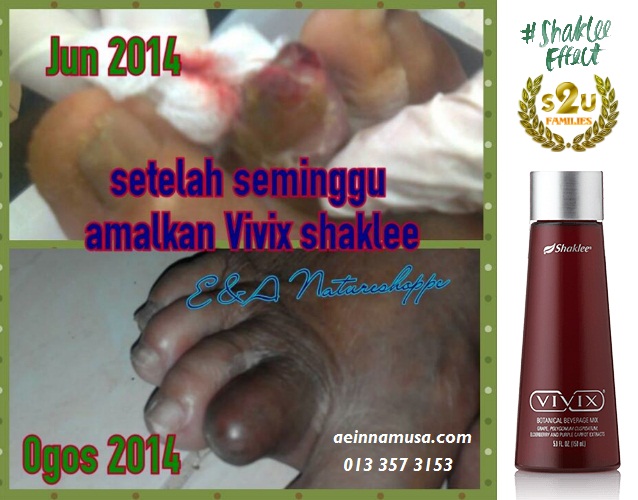 28+ Rahsia Jari Kaki Gif