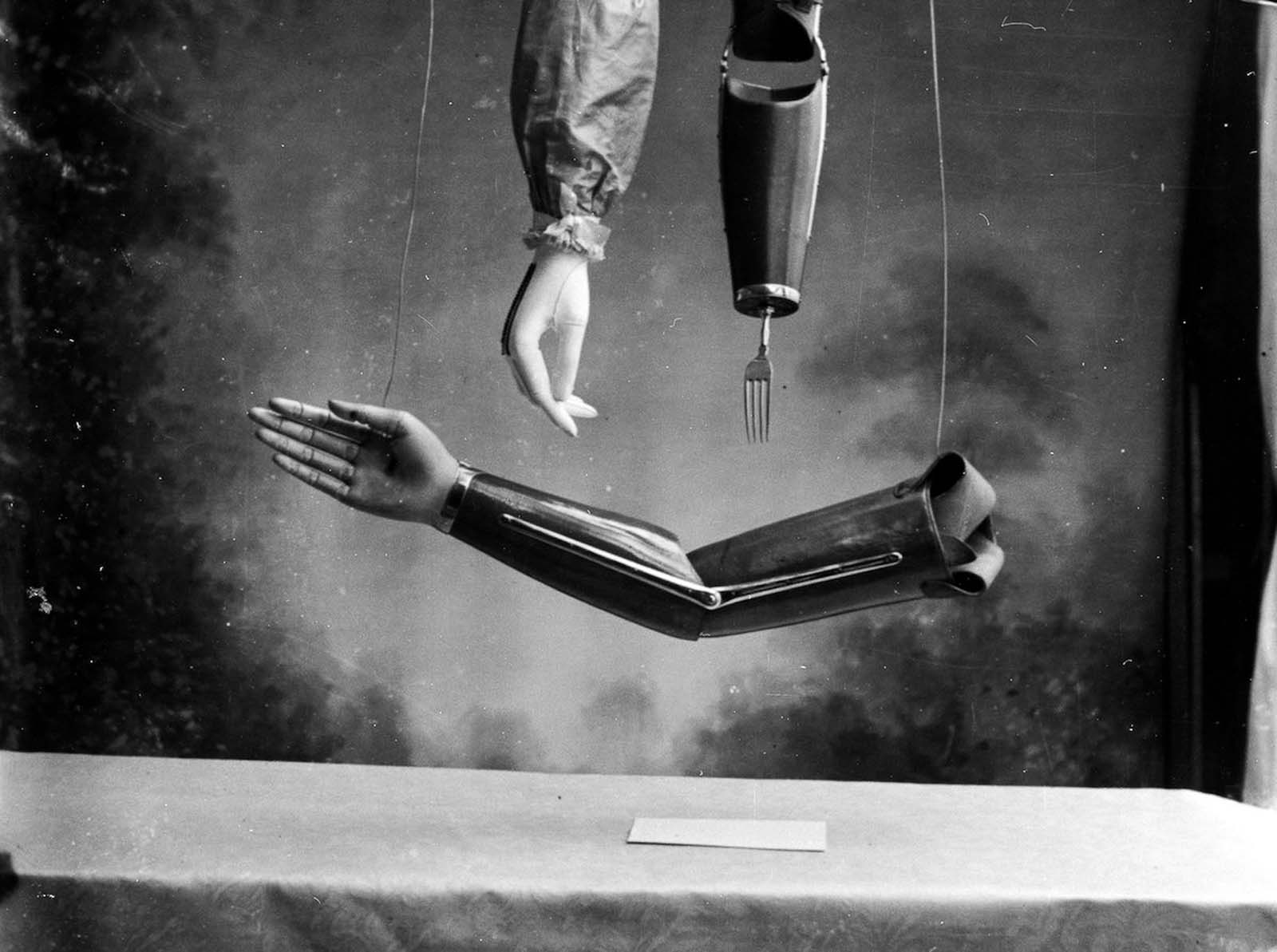 The extraordinary early prostheses made by James Gillingham  1900 - 42