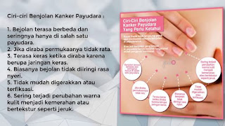 jamu obat kanker payudara, cara membuat obat kanker payudara dengan daun sirsak, obat kanker payudara terbaru, komplikasi kanker payudara, obat herbal pasca operasi kanker payudara, kanker payudara doc, kapsul herbal kanker payudara, perbedaan kanker payudara pada pria dan wanita, obat kanker payudara di apotik, obat untuk luka kanker payudara, kanker payudara stadium 4, obat herbal kanker payudara ganas, harga obat kanker payudara, obat tradisional gejala kanker payudara, ramuan herbal pencegah kanker payudara, kanker payudara pada ibu hamil, cara menyembuhkan kanker payudara secara alami, vaksin kanker payudara news, obat herbal kanker payudara stadium akhir, cara mengobati kanker payudara pada pria, jual obat tradisional kanker payudara, mengatasi kanker payudara sejak dini, kanker payudara apakah bisa sembuh, pengobatan kanker payudara stadium 1, pengobatan kanker payudara rompi, cara mengobati kanker payudara dengan alami, operasi kanker payudara gratis