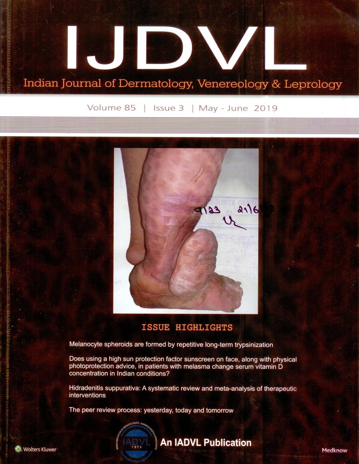 http://www.ijdvl.com/showBackIssue.asp?issn=0378-6323;year=2019;volume=85;issue=3;month=May-June