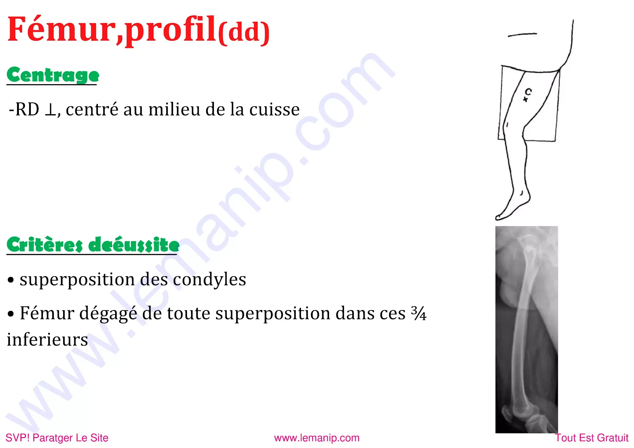 Femur De profil