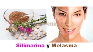 Silimarina y Melasma