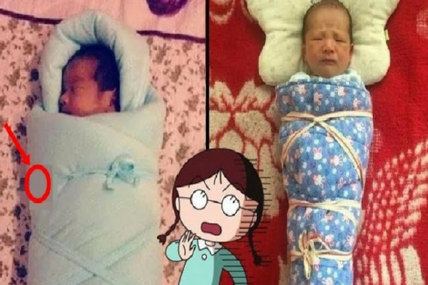 Mengejutkan, Saat Bayi ini Diperiksa Tali Pusarnya, Dokter Syok Lihat isi Dalam Selimutnya Mengejutkan, Saat Bayi ini Diperiksa Tali Pusarnya, Dokter Syok Lihat isi Dalam Selimutnya