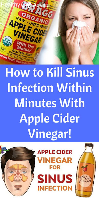 How to Kill Sinus Infection Within Minutes With Apple Cider Vinegar!