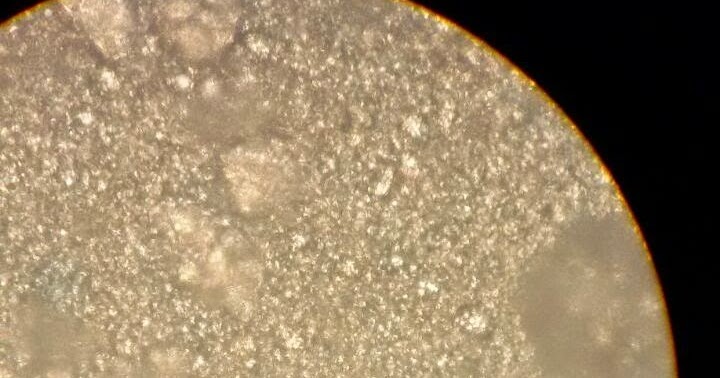 Gambar Granula dari Tepung Beras di Bawah Mikroskop ~ SKY HIGH