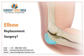 Elbow Surgery in India
