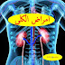 9 علامات تدل على الفشل الكلوى وحصوات الكلى 9 علامات تدل على الفشل الكلوى وحصوات الكلى