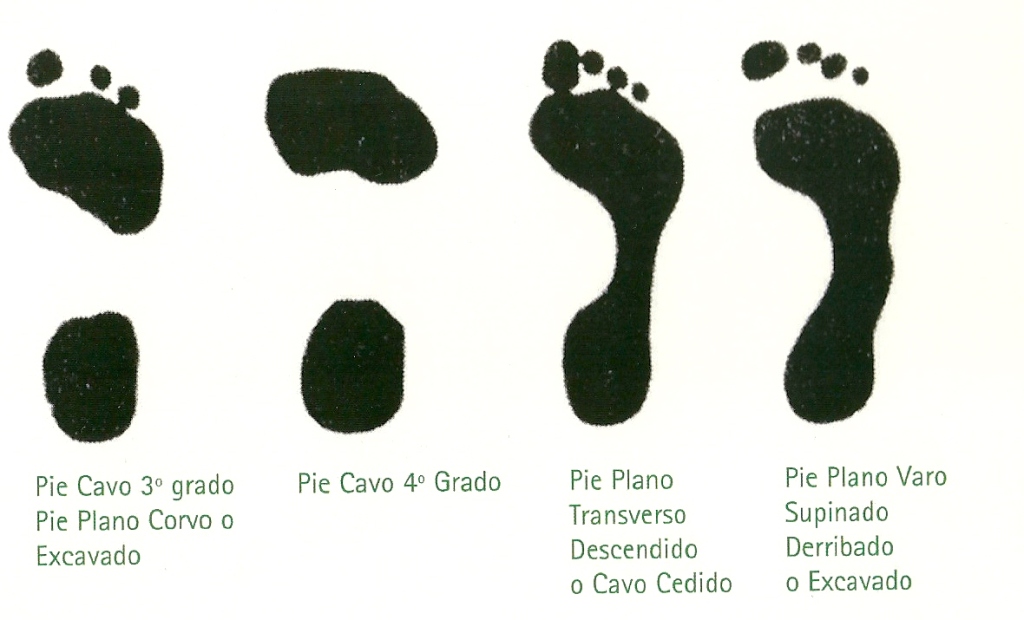 Productos y Servicios para tus pies y cuerpo Podología Pie Normal