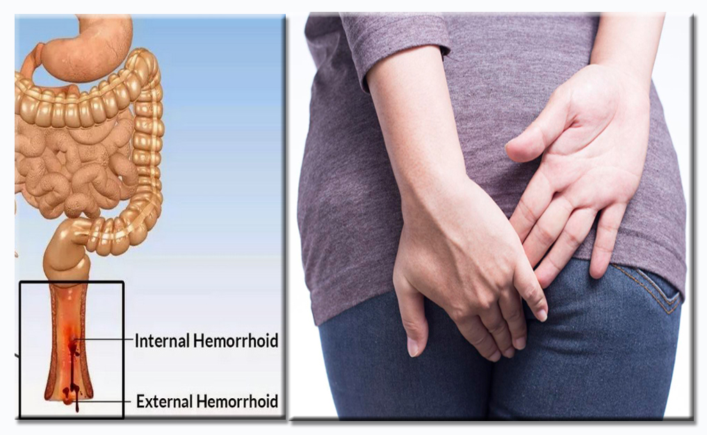 Penjelasan, Gejala serta Tips Mengatasinya