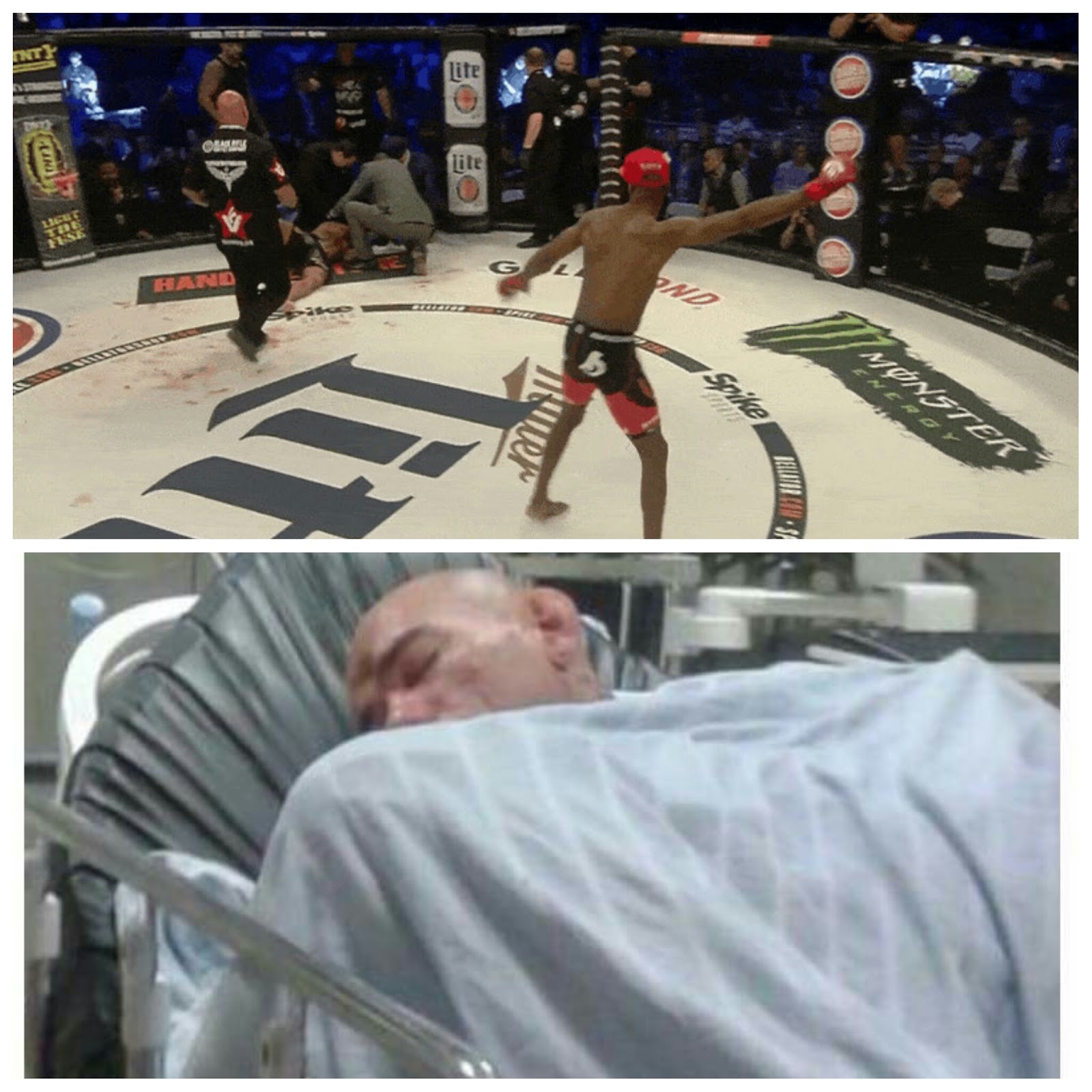 Michael Page's Flying Knee Fractured Santos' Skull