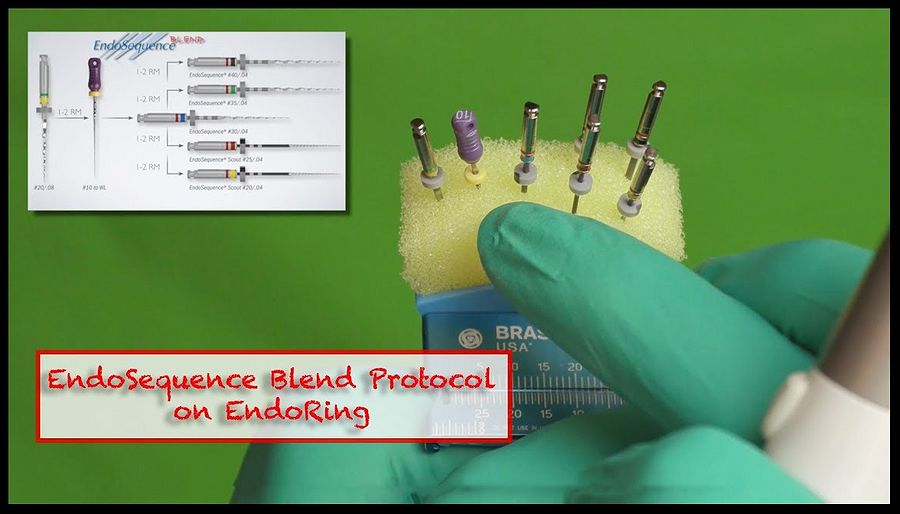 ENDODONTICS EndoSequence Blend Technique Dr. Nasseh
