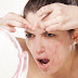 Acne(Pimple) Care and 16 Natural Treatments