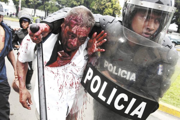 Resultado de imagen para nicaragua represion