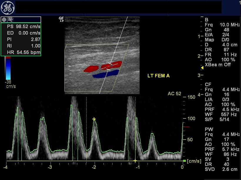 Ultrasound imaging July 2012