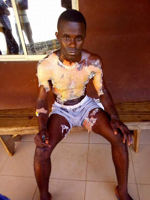  Photos: Health student throws mixture of hot water, pepper and salt on her male colleague in Calabar