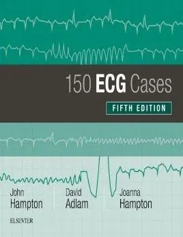 Buku PDF 150 ECG Cases – 5th edition