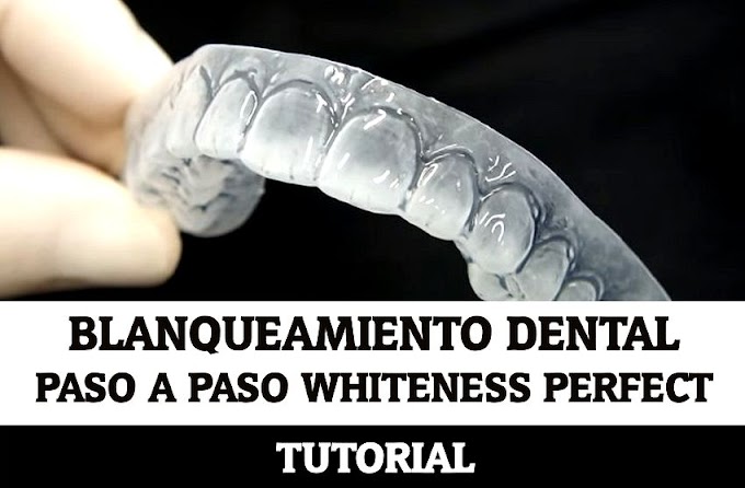 BLANQUEAMIENTO DENTAL: Paso a Paso Whiteness Perfect