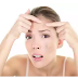 Best Home Remedies To Get Rid Pimples And Acne Naturally