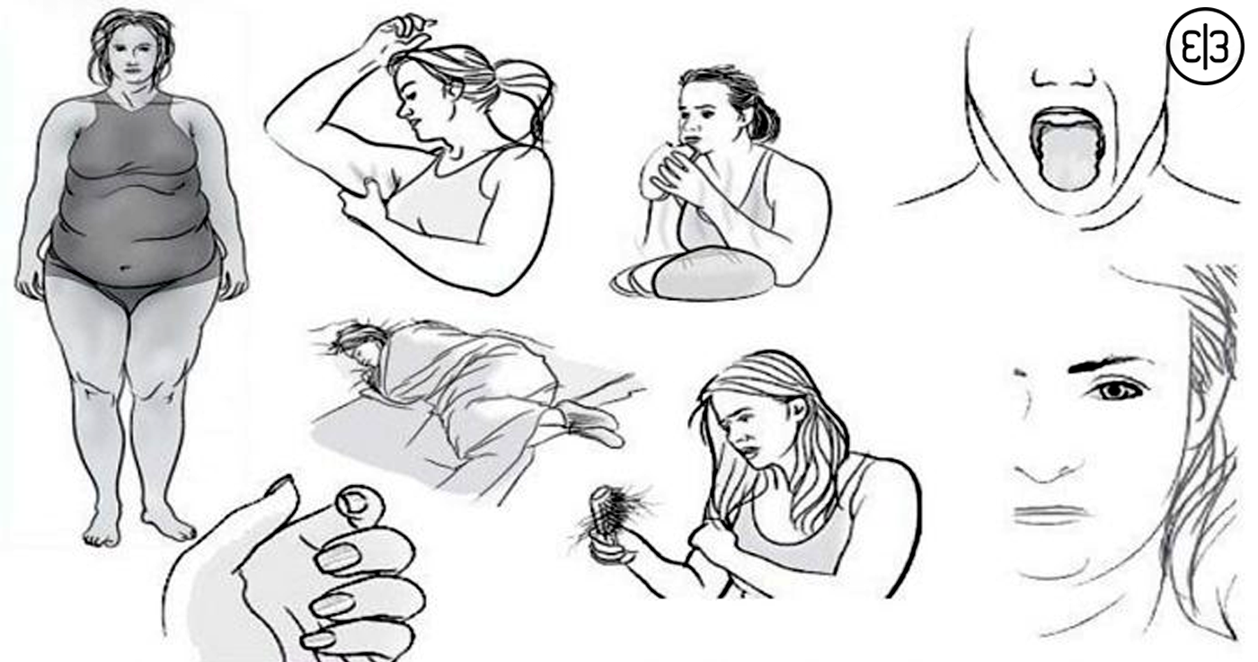 дисфункция щитовидной железы у женщин