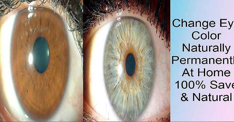 How To Change Your Eyes Color Naturally & Permanently 100% Save - The ...