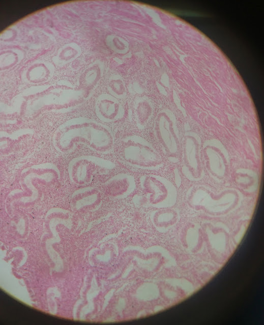 histology slide of uterus in proliferating phase