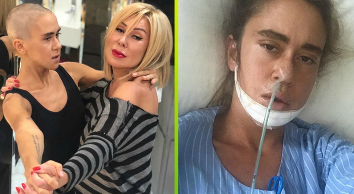 Татьяна плаксина до и после пластики