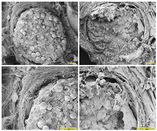 Изображение №5: анализ РЭМ (растровый электронный микроскоп) снимков образцов с гиперэластичной костью.