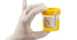urina orina amostra muestra urine urin pemeriksaan handschoen mikroskopik luva guante enam pipis indikasi berbau penyakit waspadai perlu berbusa ini