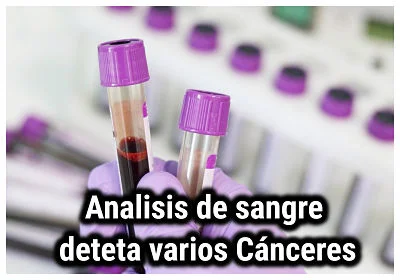 El análisis de sangre puede detectar muchos cánceres ocultos 