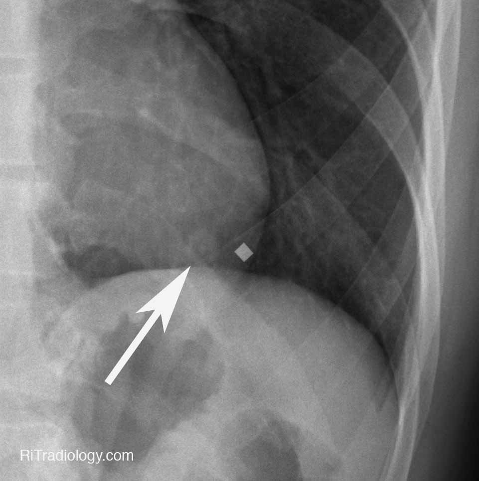 RiT radiology December 2011