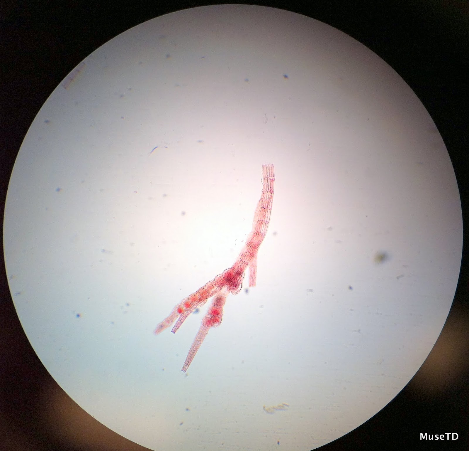 MICROBIOLOGY SLIDE SPECIMENS