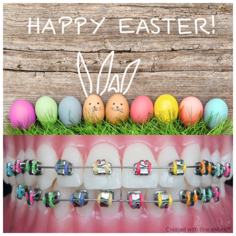 Spannhake Orthodontics How To Enjoy Easter With Braces