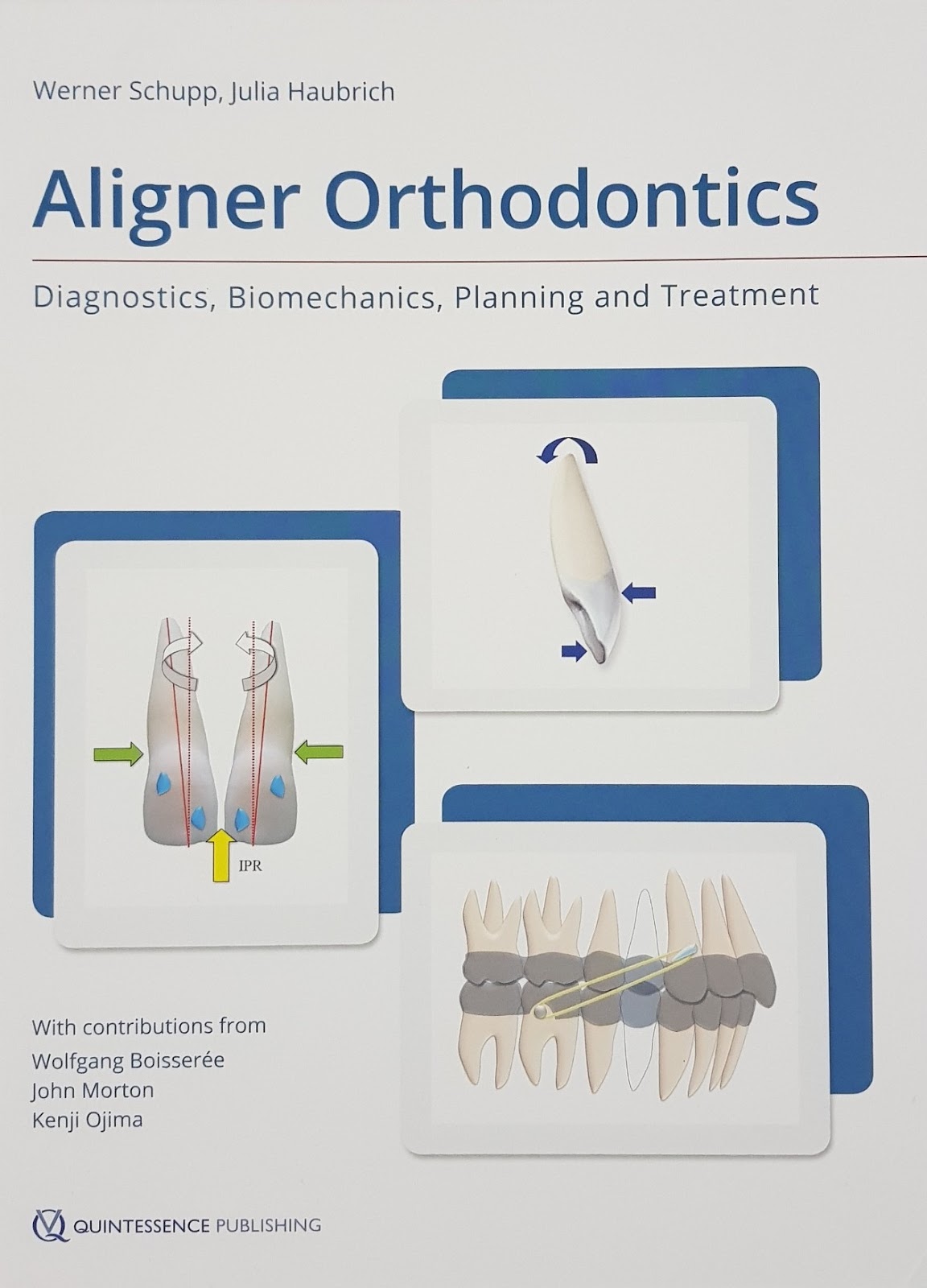 Aligner Orthodontics Diagnostics Biomechanics Planning and Treatment