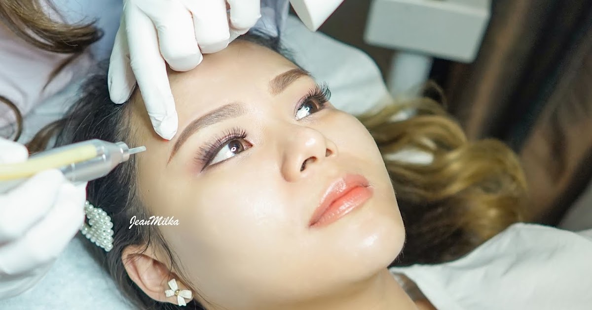 Pengalaman Treatment Jerawat Dan Bekas Jerawat Di Erha Derma Center Jean Milka