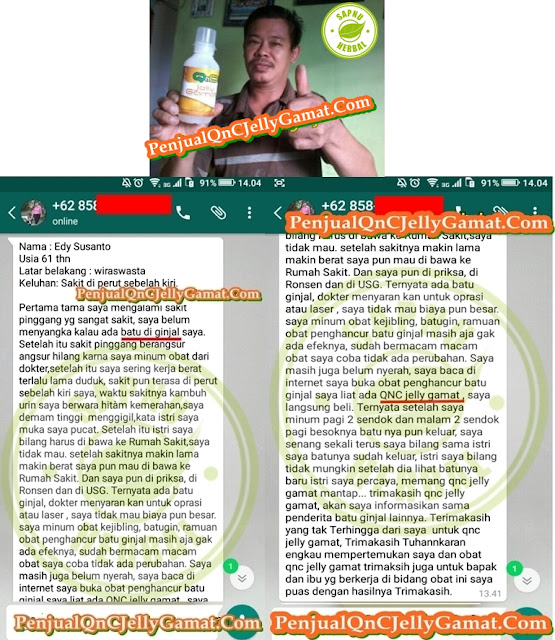 Obat Penghancur Batu Ginjal Yang Paling Manjur di Apotik 100% Aman Utk Semua Usia Obat Penghancur Batu Ginjal Yang Paling Manjur di Apotik 100% Aman Utk Semua Usia
