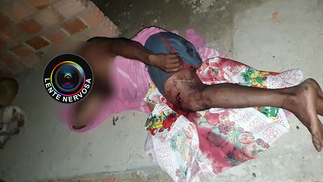 Homem é baleado enquanto mantinha relação sexual com porca em sítio - VEJA VÍDEO