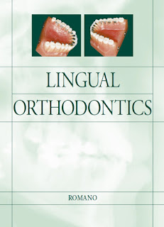 Lingual Orthodontics by Rafi Romano