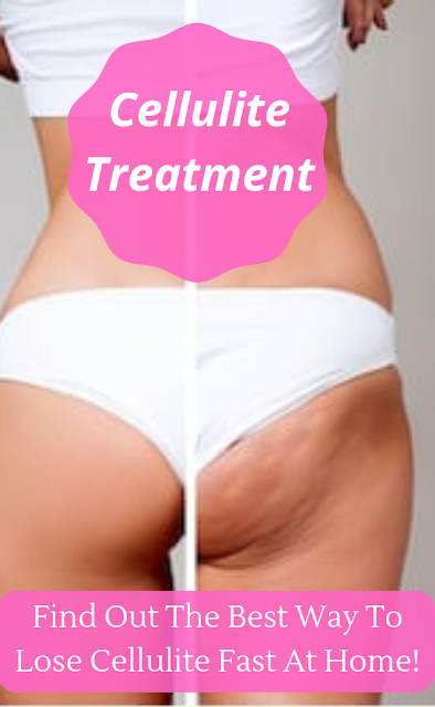 Find Out The Best Way To Lose Cellulite Fast At Home