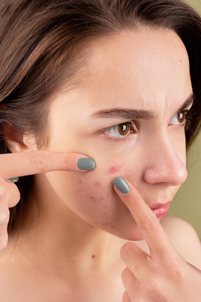 Pimples Under Skin: 6 Ways for treatment