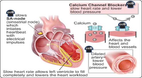 Caring Treatment: What Cause High Blood Pressure - High Blood Pressure