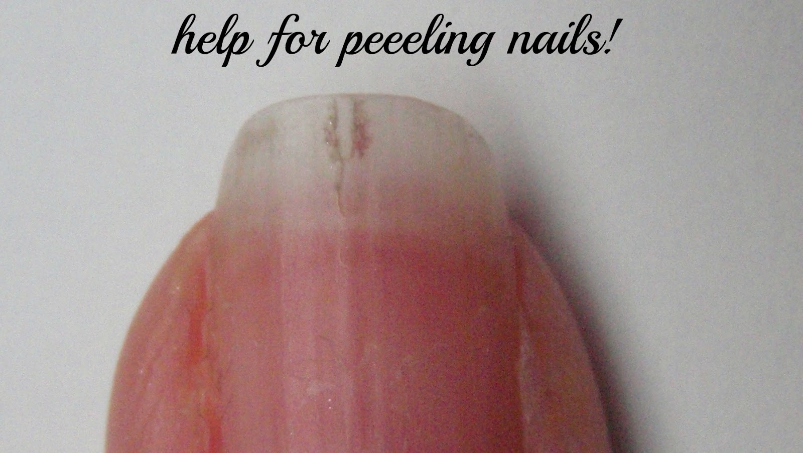 Peeling Nails should you file or not to file? Peeling Nails Treatment