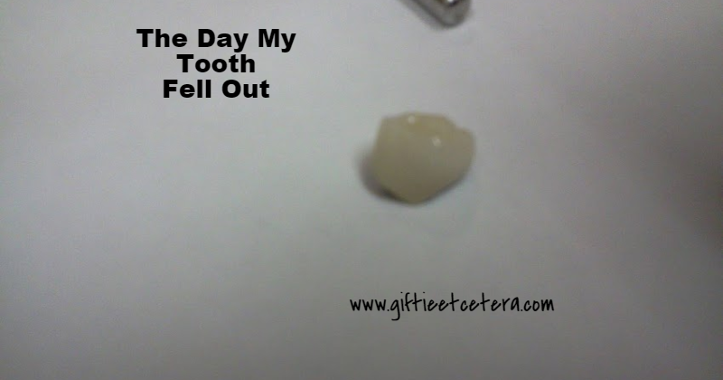 The Day My Tooth Fell Out | Giftie Etcetera: The Day My Tooth Fell Out