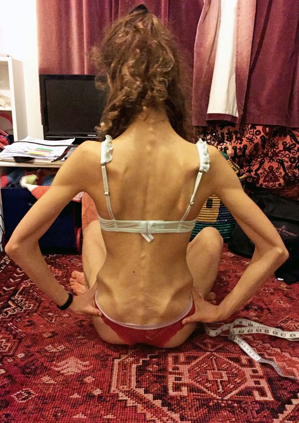 See what Anorexic teen ballet dancer caused herself after cr