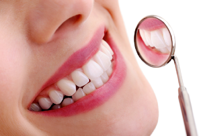 Độ bền phục hình răng sứ được bao lâu ?