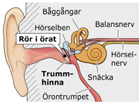 Bessie-bessi: Att få plaströr i öra