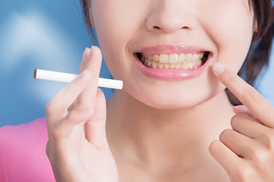  Làm sao để răng không bị ố vàng?
